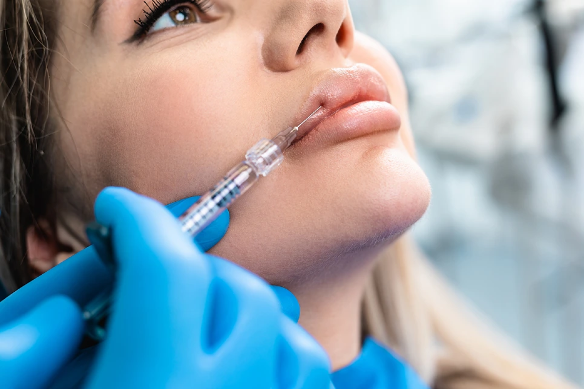 How Lip Fillers Can Enhance Your Self-Confidence? by fatimadynamic