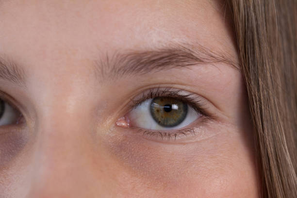 Is Blepharoplasty Safe For Sensitive Eyes? by Enfieldabudhabi