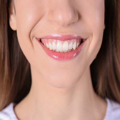 How Much Gum Tissue Is Removed During Contouring? by Aesthethic Clinic