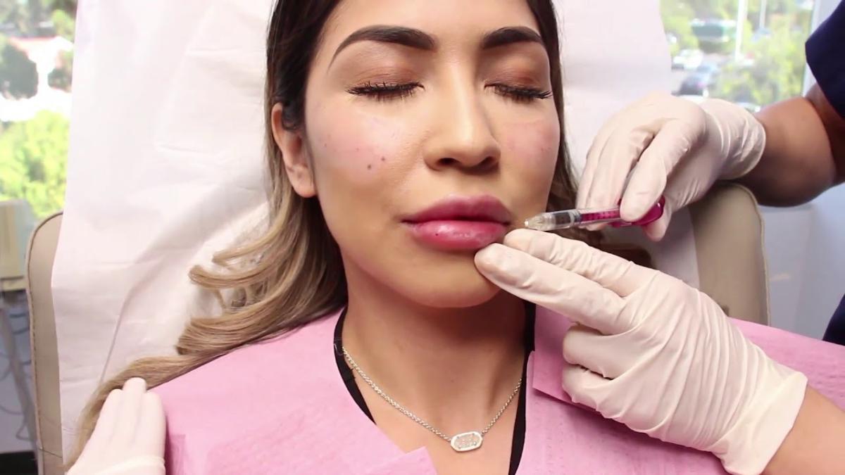 How Can Botox Lip Flip Improve Your Lip Symmetry Safely? by Dynamicclinic12