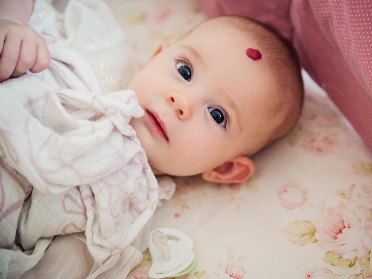 What Causes Birthmarks And Can They Reappear? by fatimadynamic