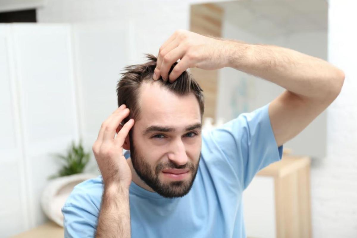 How Can You Maximize Hair Loss Treatment Benefits? How Can You Maximize Hair Loss Treatment Benefits? by eirhakhan