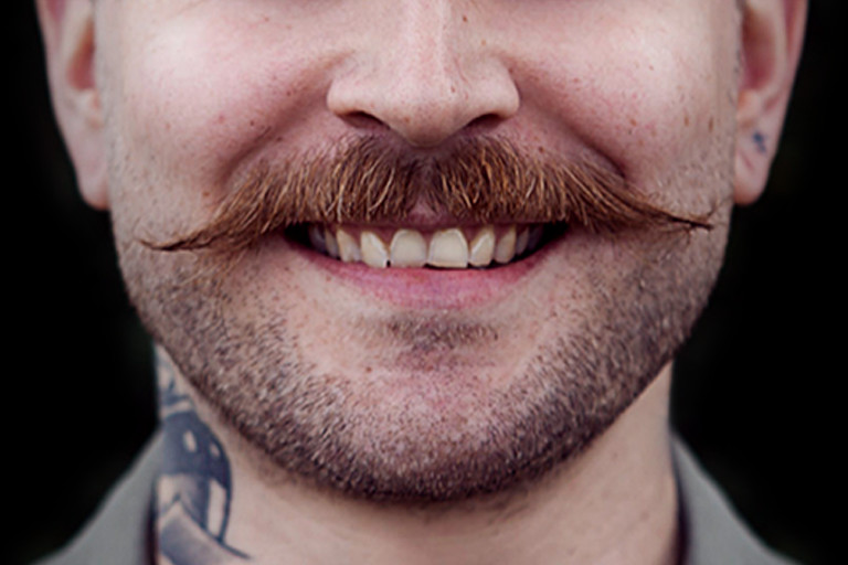 Can A Mustache Transplant Boost Self-confidence? by fatimadynamic