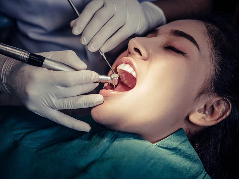 How Does Root Canal Treatment Affect Tooth Structure? by glamorous