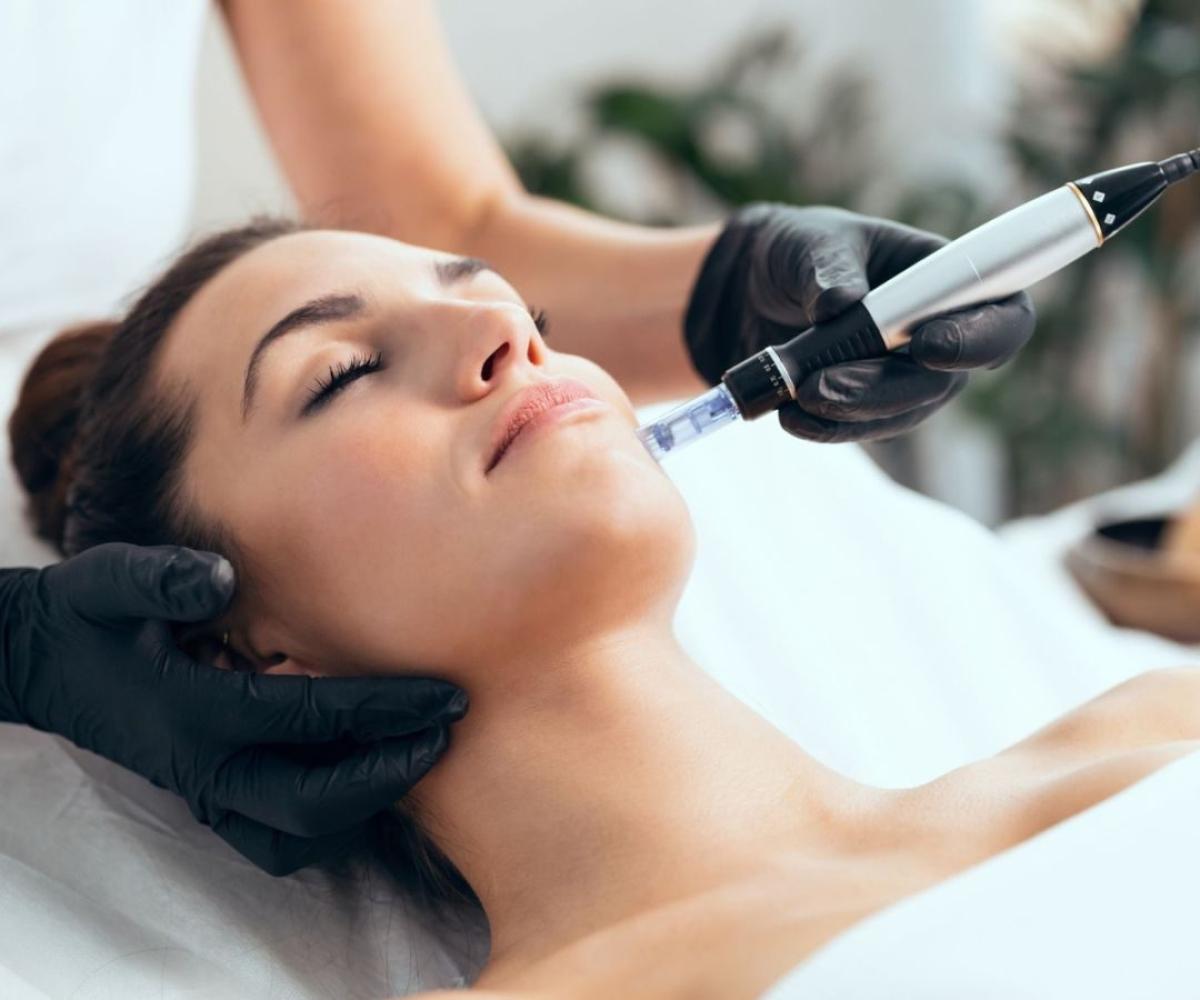 Can Microneedling Reduce Fine Lines And Wrinkles? by cdynmic