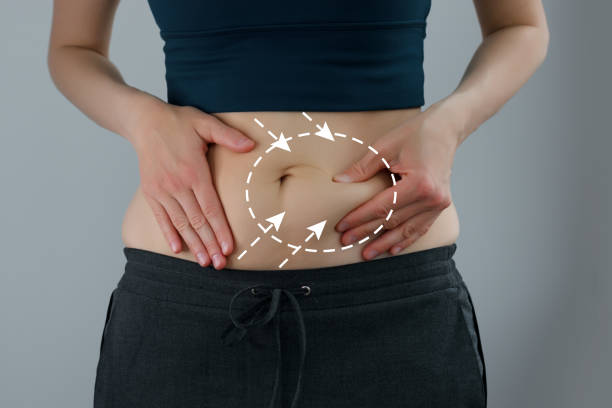 Tummy Tuck In Riyadh After Pregnancy: Restoring Your Confidence by Royal Clinic Saudia