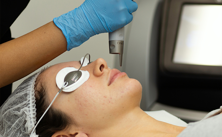 What Science Supports Pico Laser Treatment? by Bisma jamal