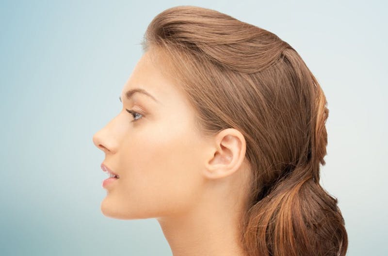 Is Liquid Rhinoplasty Suitable For Correcting Droopy Tips? Is Liquid Rhinoplasty Suitable For Correcting Droopy Tips? by MuhammadAhmad