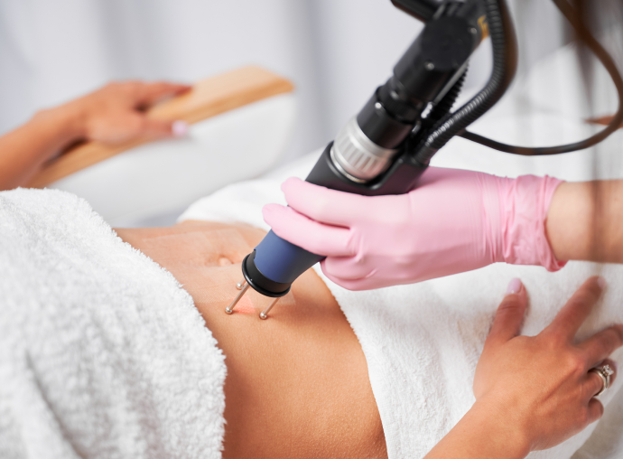 Scar Removal Dubai Unlocks Confidence And Radiance Instantly by pookie46