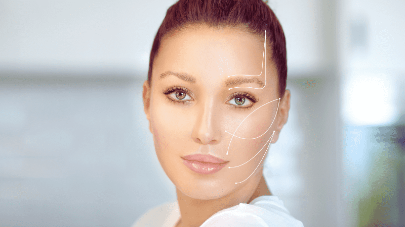 Is Fotona 4D For Facelift Considered Minimally Invasive? by Taimoor Tahir