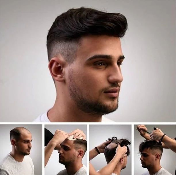 Top Place To Buy Men’s Hairpieces Near Me: Hairpiece Warehouse Top Place To Buy Men’s Hairpieces Near Me: Hairpiece Warehouse by hairpiece