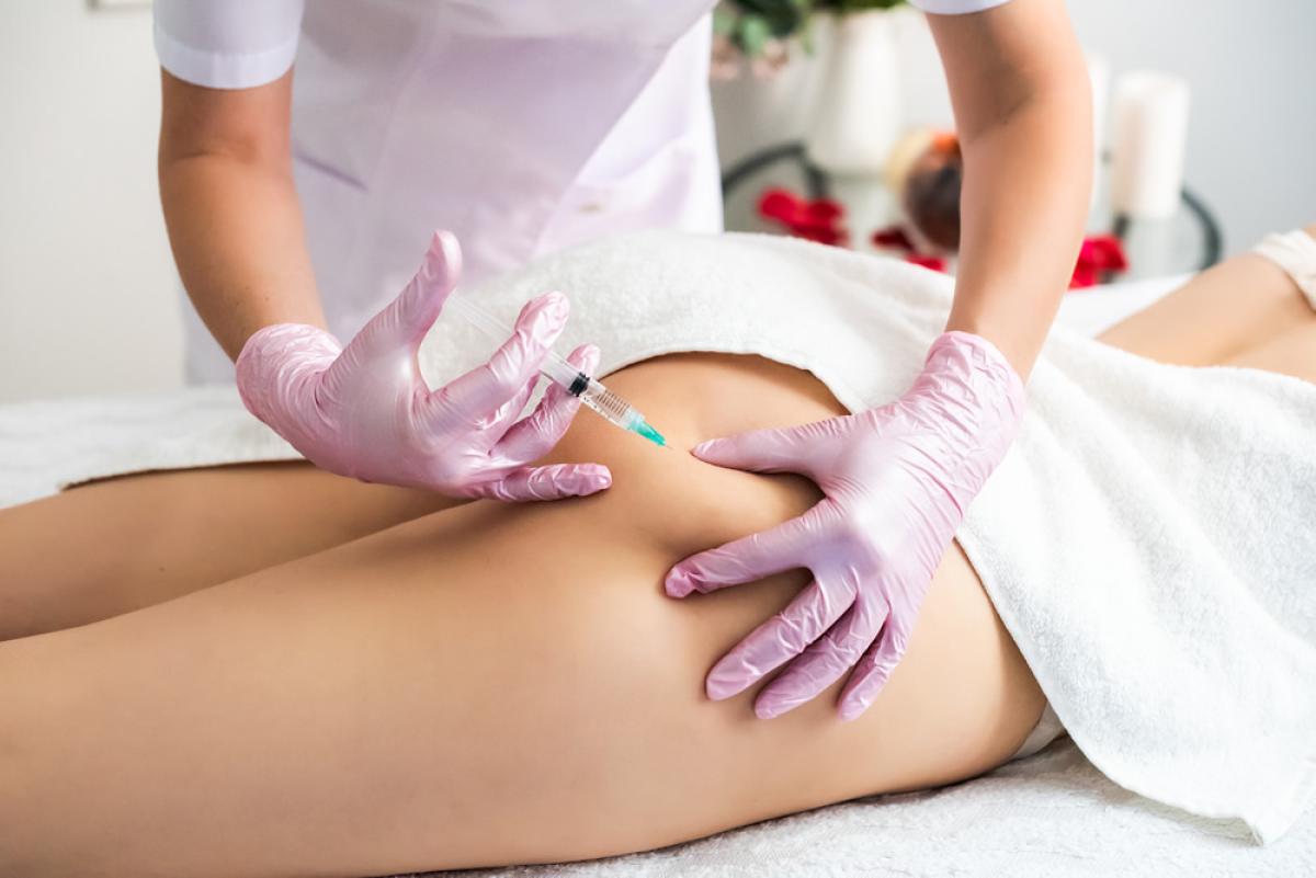 What Are The Different Types Of Butt Fillers? What Are The Different Types Of Butt Fillers? by eirhakhan