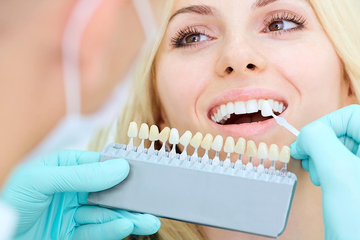 Can Teeth Whitening In Islamabad Improve Personal Confidence Daily? by glamorous
