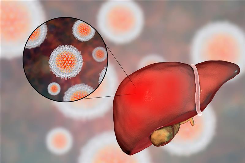 Alcoholic Liver Disease Treatment: Steps That Slow Or Stop Cirrhosis by Transplant Liver India