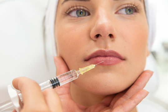 Does Botox Lip Flip Create Fuller Lips With No Volume? by Dynamicclinic12