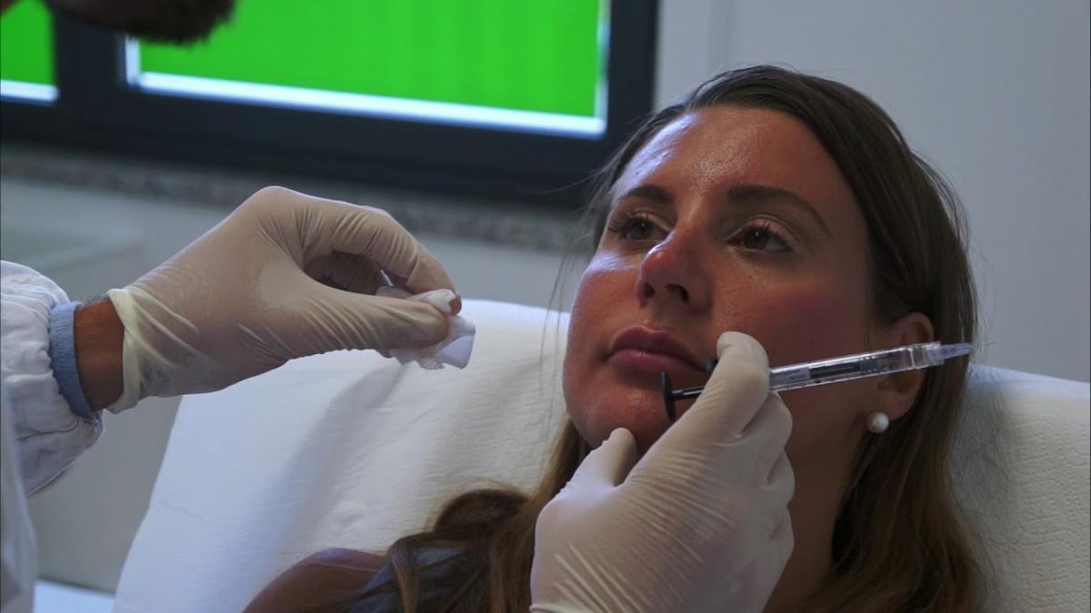 Why Choose Juvederm Filler For Natural Lip Enhancement? by Dynamicclinic12