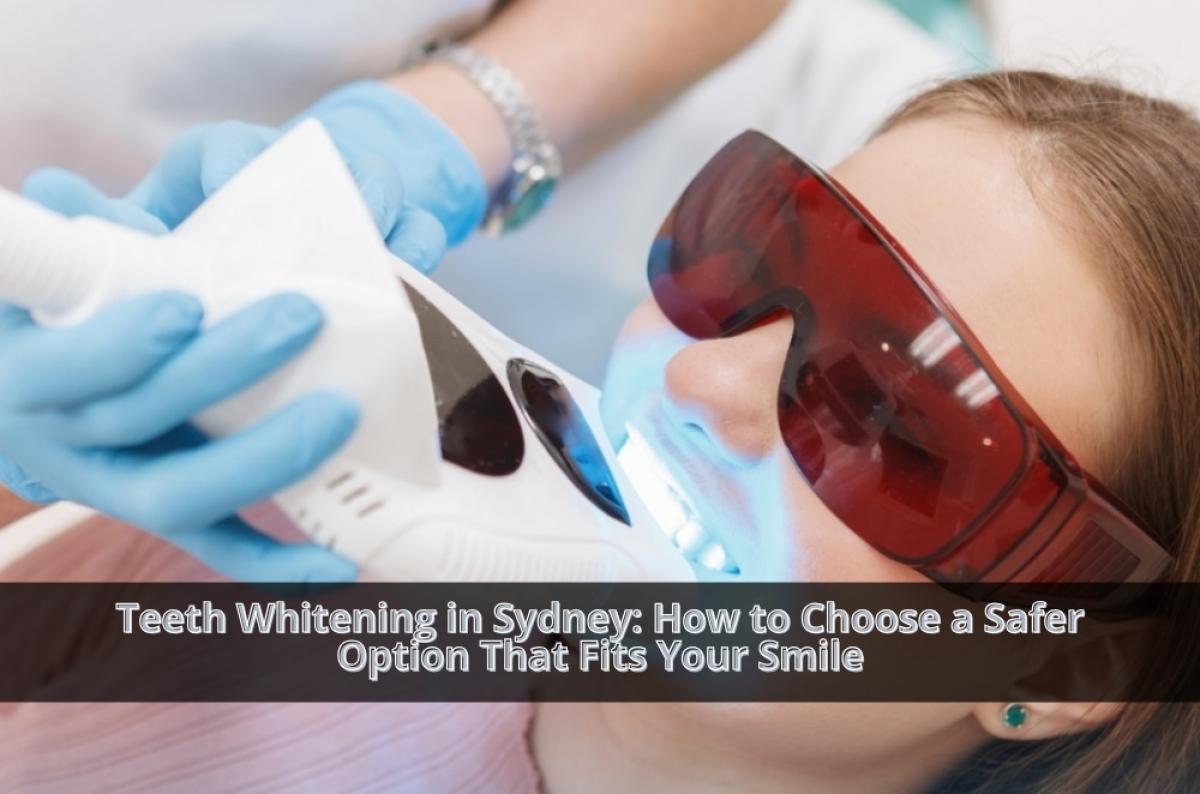 Teeth Whitening In Sydney: How To Choose A Safer Option That Fits Your Smile by clairemile