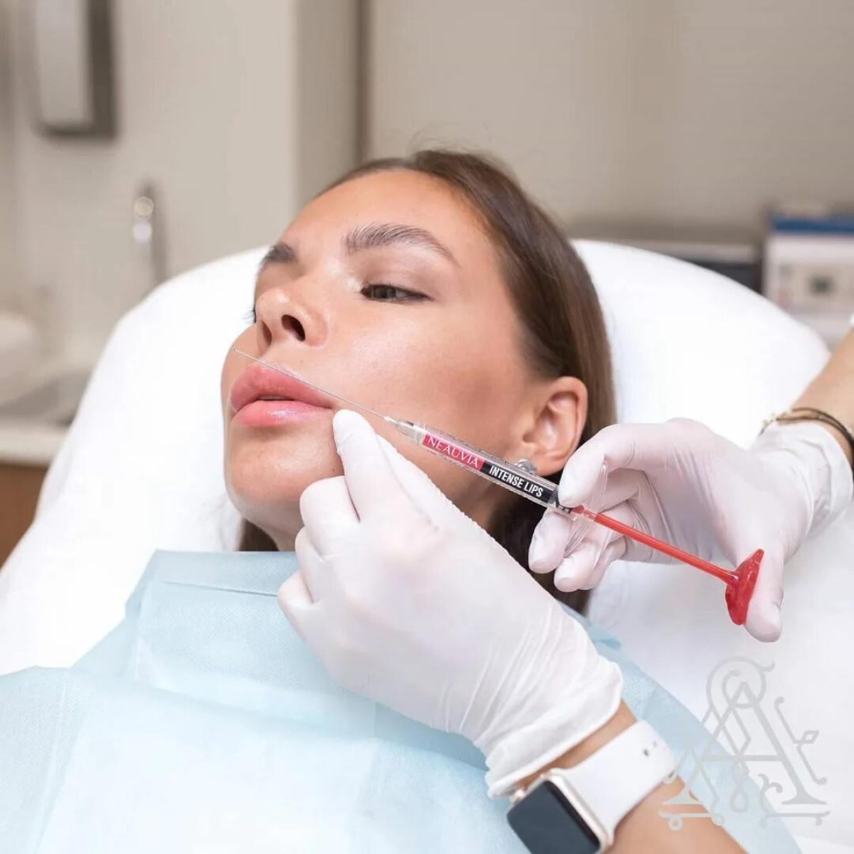 Do Russian Lip Fillers Improve Cupid’s Bow Shape? by Dynamic Life Clinics