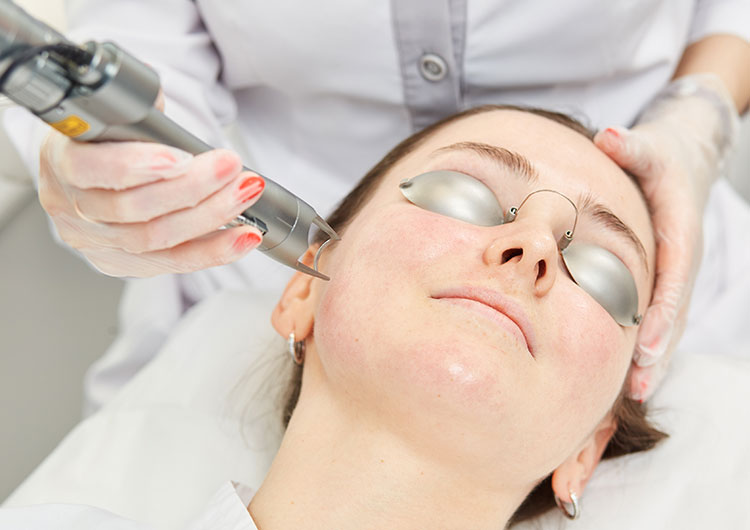 Does Pico Laser Work On Melasma And Dark Patches? by Enfieldabudhabi