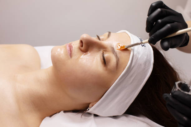 Chemical Peels In Riyadh And Their Role In Managing Oily Skin by mominenfield