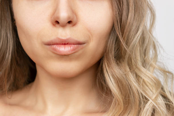 Does Buccal Fat Removal Slim The Face? by Enfieldabudhabi