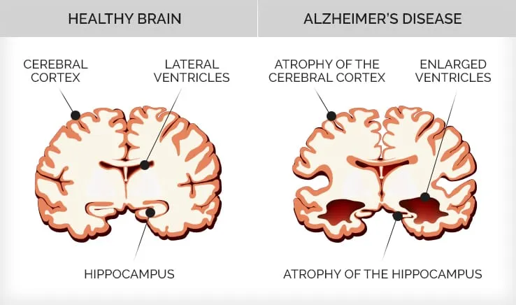 active and healthy brain if you play ping pong