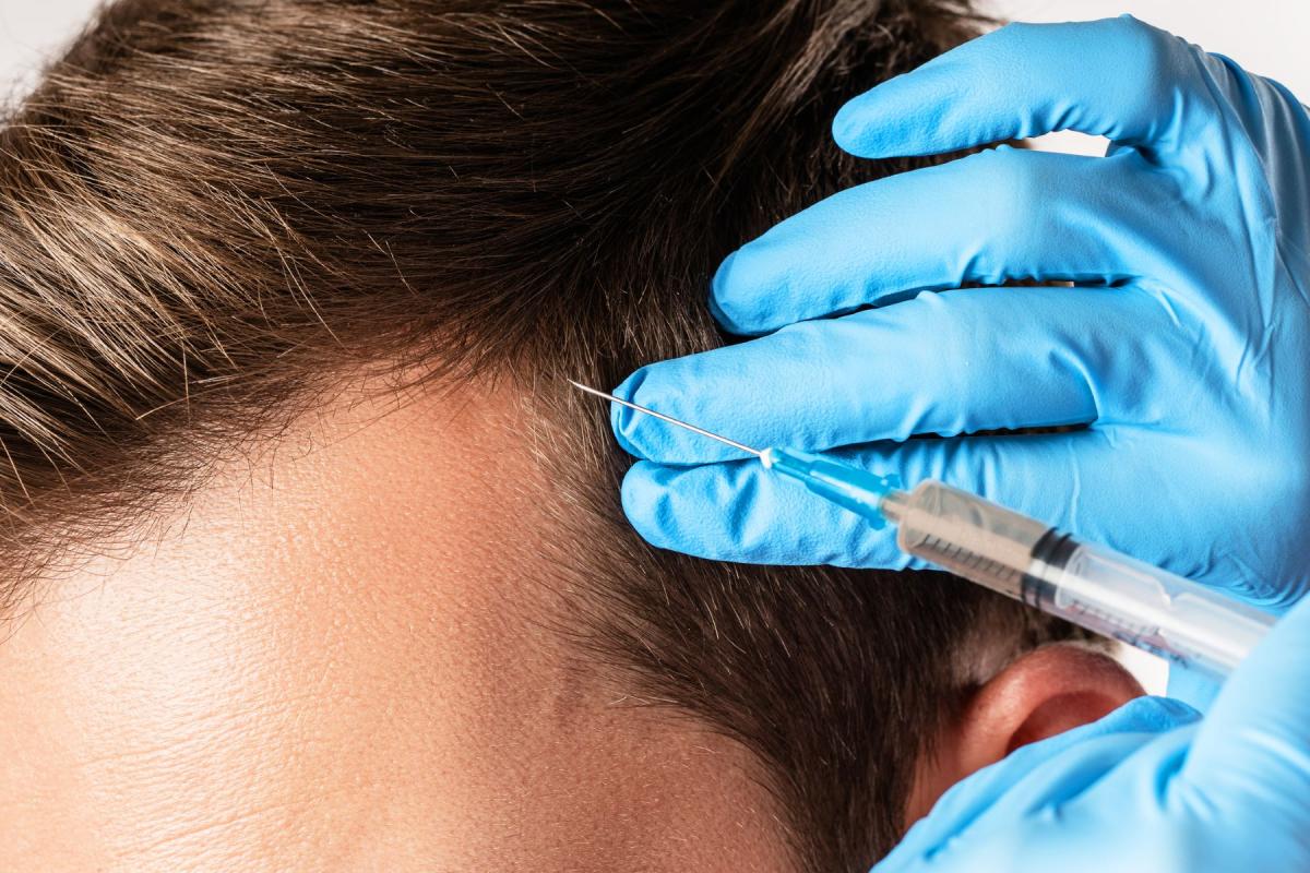 Can G Cell Hair Treatment Work For Early Hairline Decline? by dynamiclifeclinics