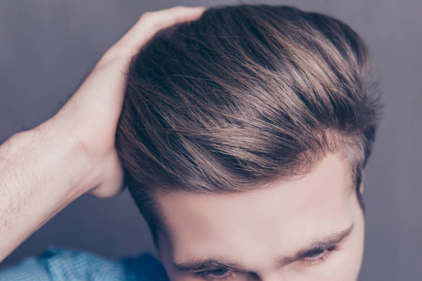 Does Hair Transplant Provide Permanent Coverage? by Enfieldabudhabi