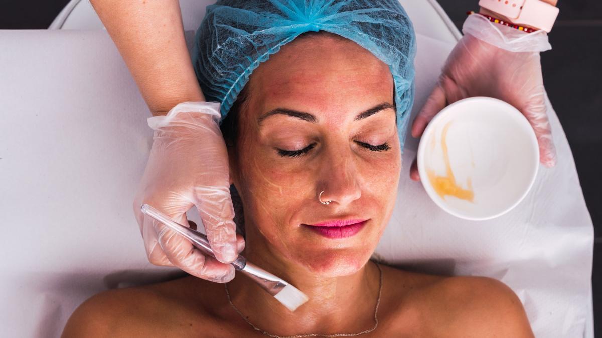 Cosmelan Peel For Reducing Dark Spots And Uneven Skin Tone by Dynamic Life Clinics