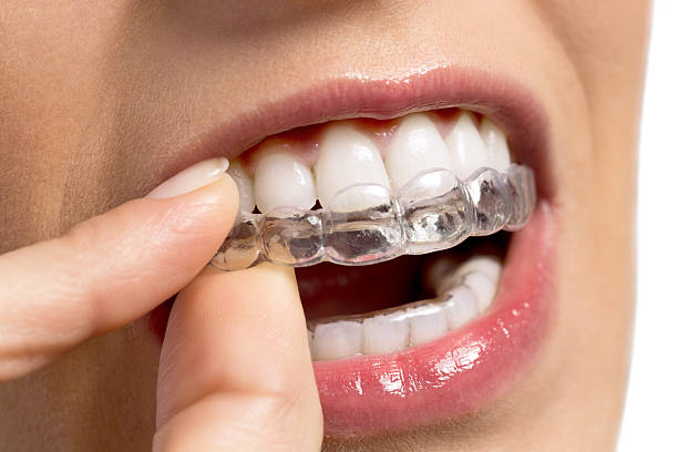Straighten Your Teeth Discreetly With Invisalign In Vinings Straighten Your Teeth Discreetly With Invisalign In Vinings by Evergreen Orthodontics