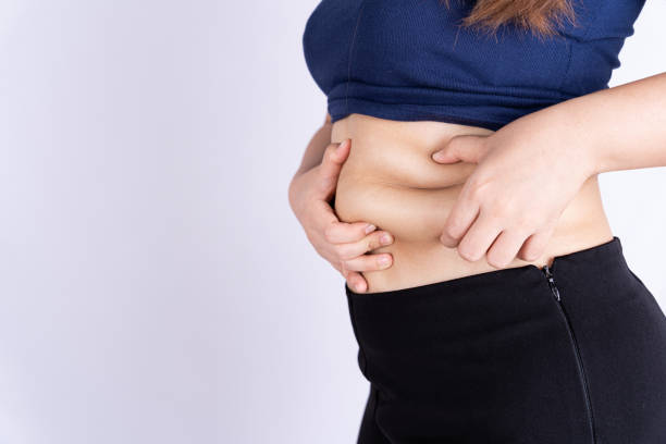 Tummy Tuck Surgery Alternatives Explored by mominenfield