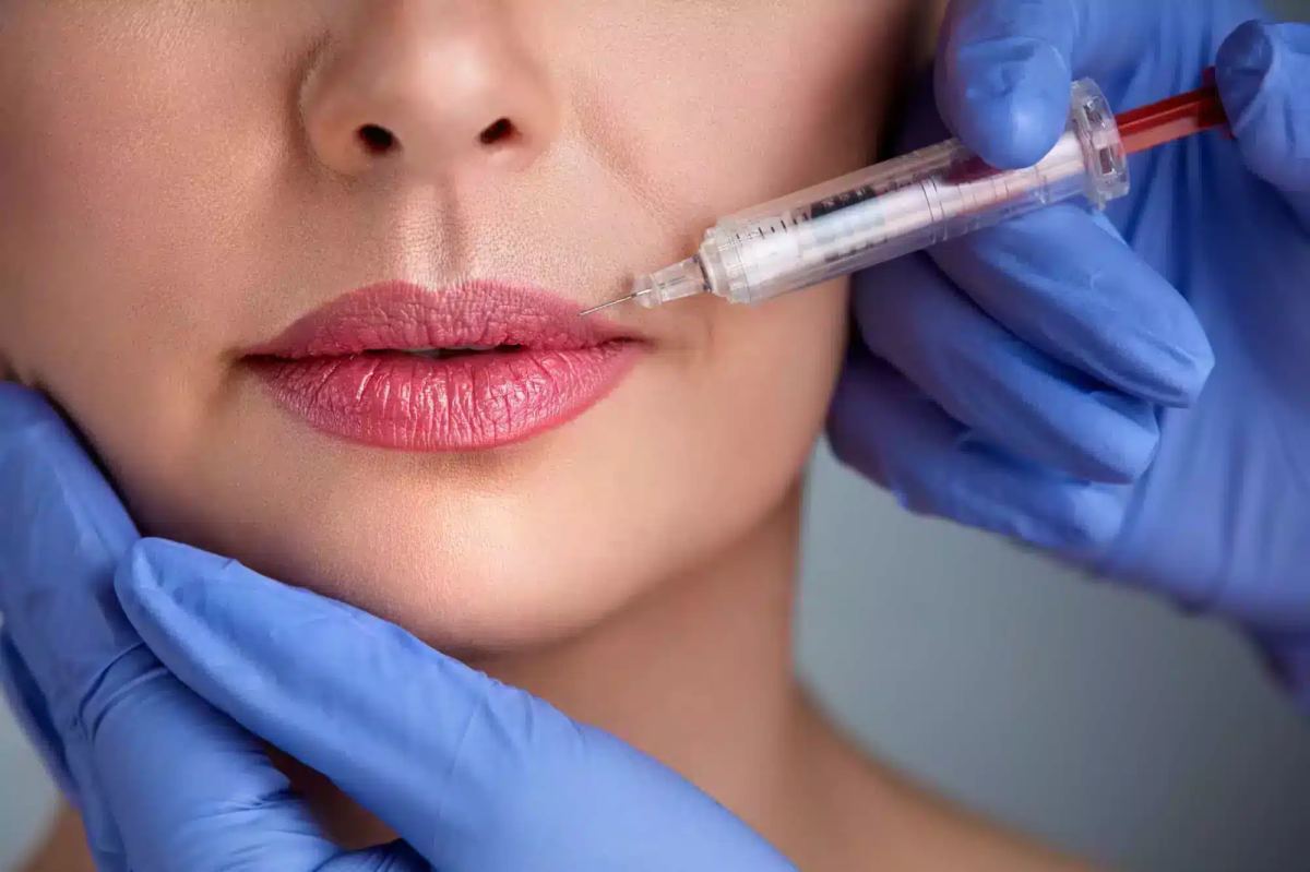 Does The Strategy For Best Russian Lip Fillers Differ? Does The Strategy For Best Russian Lip Fillers Differ? by eirhakhan