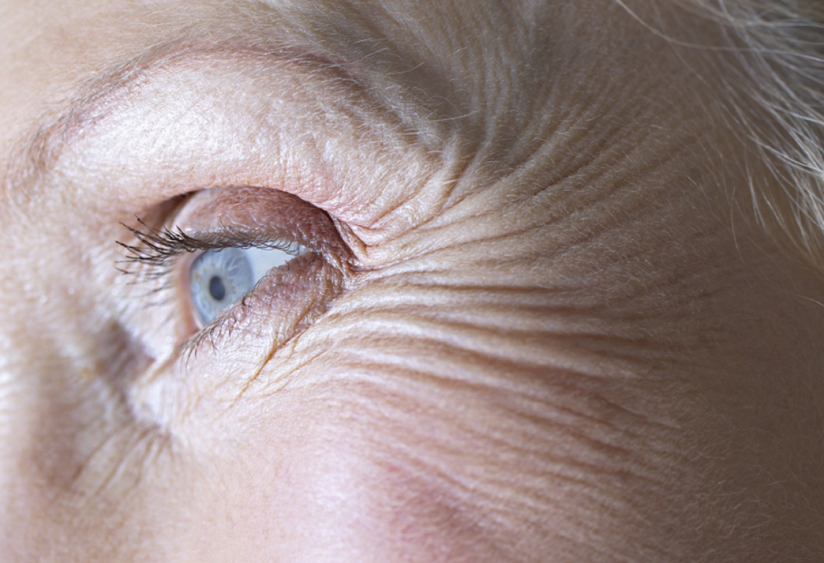 Does The Best Botox For Wrinkles Target Specific Lines? Does The Best Botox For Wrinkles Target Specific Lines? by eirhakhan
