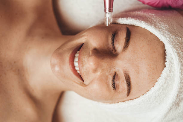 How Long Do Results From Microneedling  Last? by Enfieldabudhabi