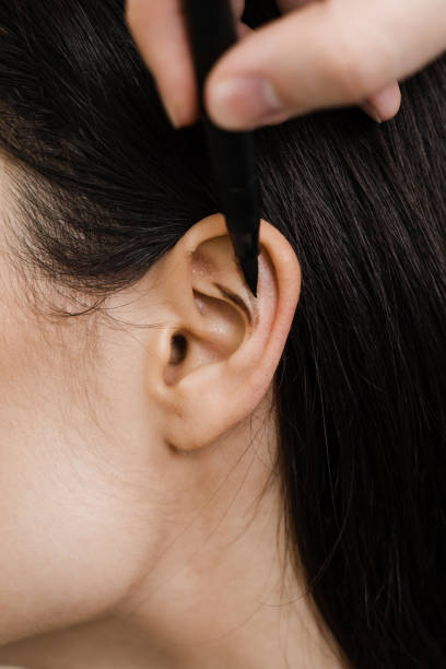 Combining Ear Reshaping Surgery In Riyadh With Other Cosmetic Procedures by momin7