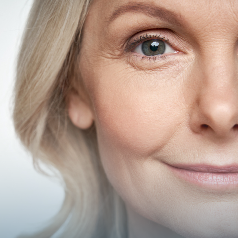 Is Electrolysis Hair Removal Permanent And Safe? by fatimadynamic