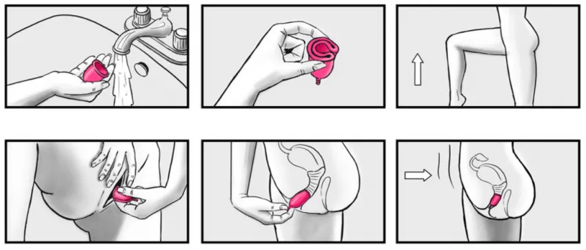 Inserting the Cup