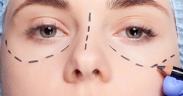 How To Prepare For Eyelash Hair Transplant? by Dynamicclinic12