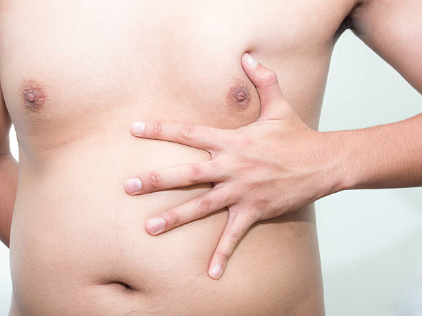 Minimally Invasive Approaches For Gynecomastia Surgery In Riyadh by Royal Clinic Saudia