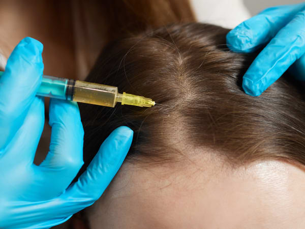 Does PRP Hair Treatment Require Multiple Sessions? Does PRP Hair Treatment Require Multiple Sessions? by eirhakhan