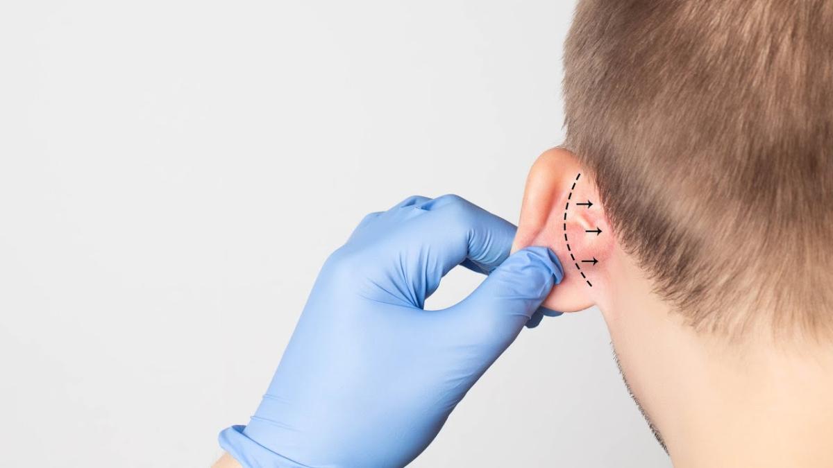 How Does Ear Surgery Correct Ear Shape? by Dynamicclinic12
