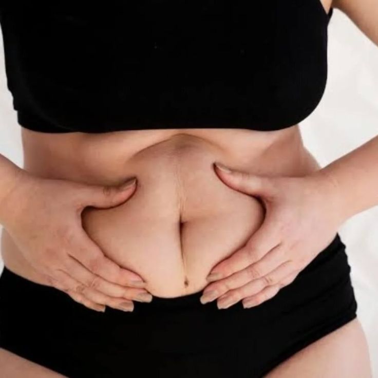 Understanding The Risks And Safety Measures Of Liposuction In Riyadh by Royal Clinic Saudia