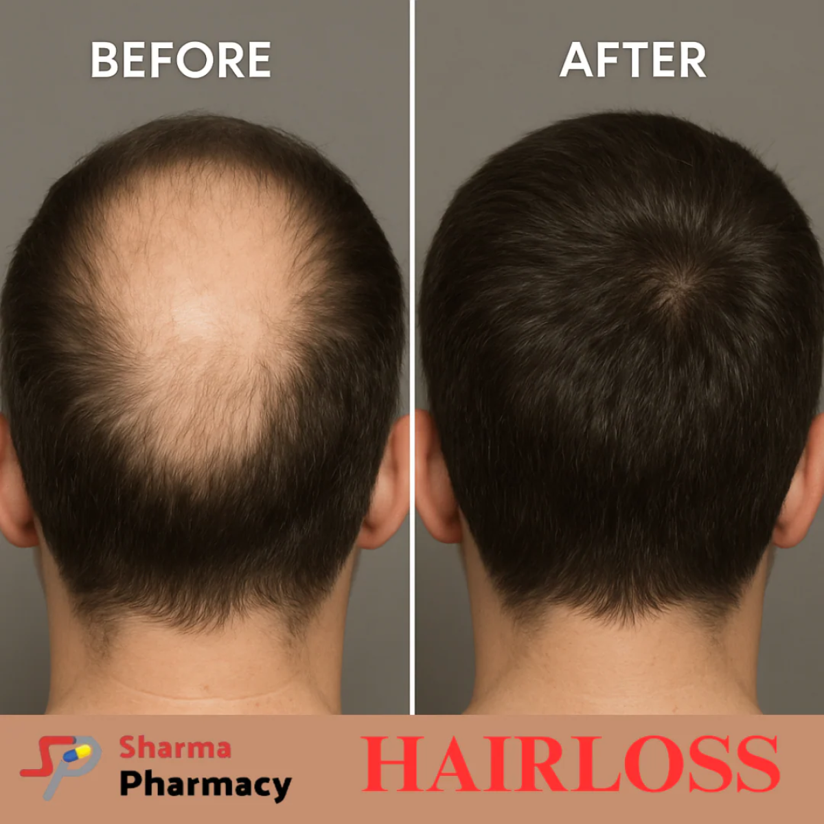 Sharma Pharmacy - Your Complete Resource For Hair & Skin Treatments In Delhi NCR by sharmapharmacy