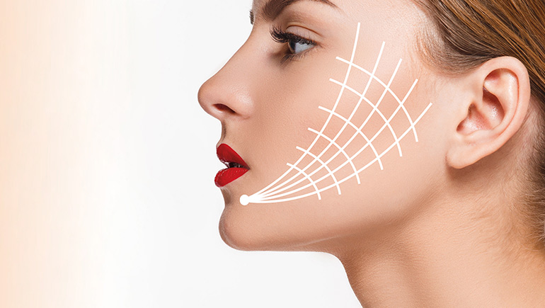 Thread Lift Tips For Redefining Facial Silhouette And Soft Tissue Volume by healthcareblog