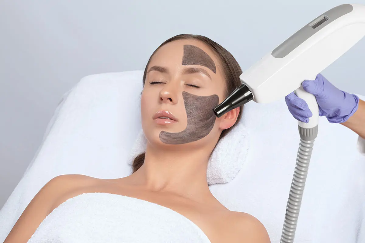 Does Laser Carbon Peel Improve Enlarged And Visible Pores? by aestheticclinicdubai6@gmail.com