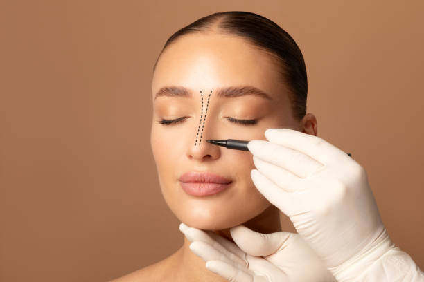 Patient Guide: Questions To Ask Before Your Rhinoplasty In Riyadh by momin7
