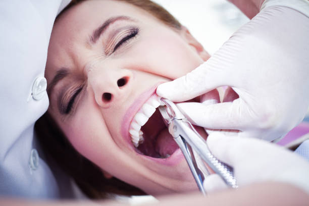 Can Tooth Removal Prevent Future Dental Infections? by Enfieldabudhabi