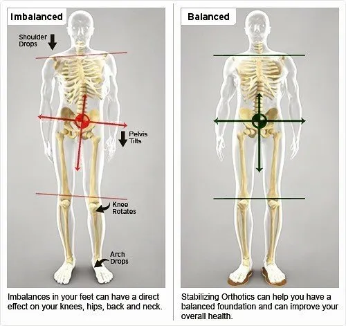 How feet affect the rest of the body
