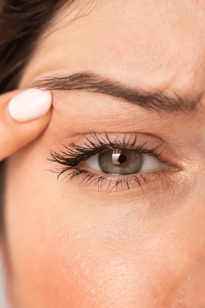 Is Eyelid Surgery Considered Major Surgery? Is Eyelid Surgery Considered Major Surgery? by MuhammadAhmad