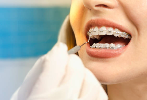 More Than Just A Straight Smile: The Health Benefits Of Orthodontic Care More Than Just A Straight Smile: The Health Benefits Of Orthodontic Care by Garfinkle Orthodontics